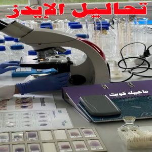 تحاليل الايدز